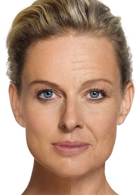 얼굴 주름살 종류와 관리 요령: 건강한 피부를 유지하는 법 2 얼굴-주름살-종류