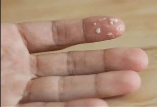 질-분비물-정상-비정상