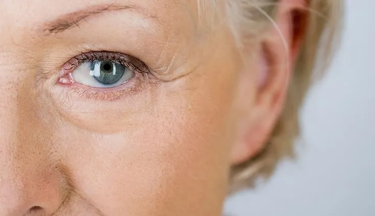 황반주름-초기증상